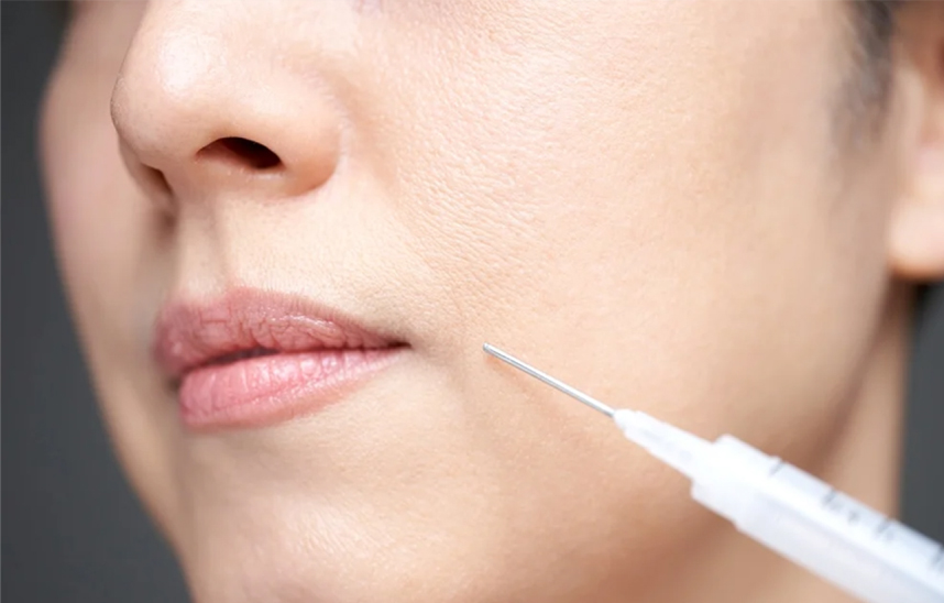 ボツリヌストキシン注射とは？