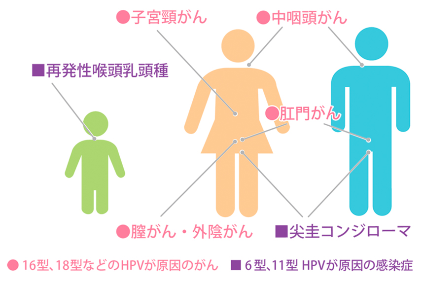 シルガード9とは？