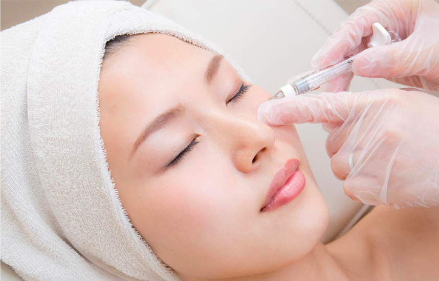 プロファイロとは？