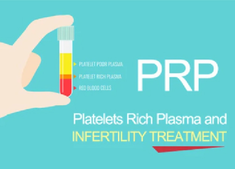 PRP治療