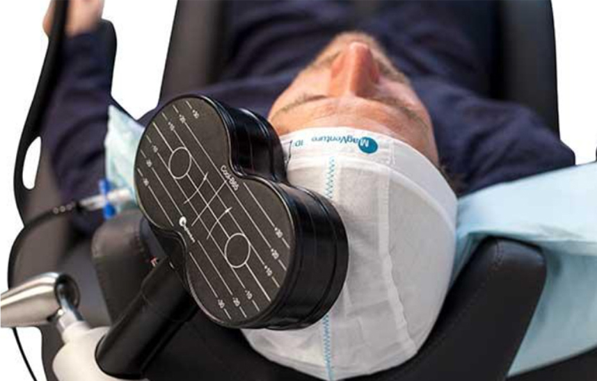 経頭蓋磁気刺激とは？