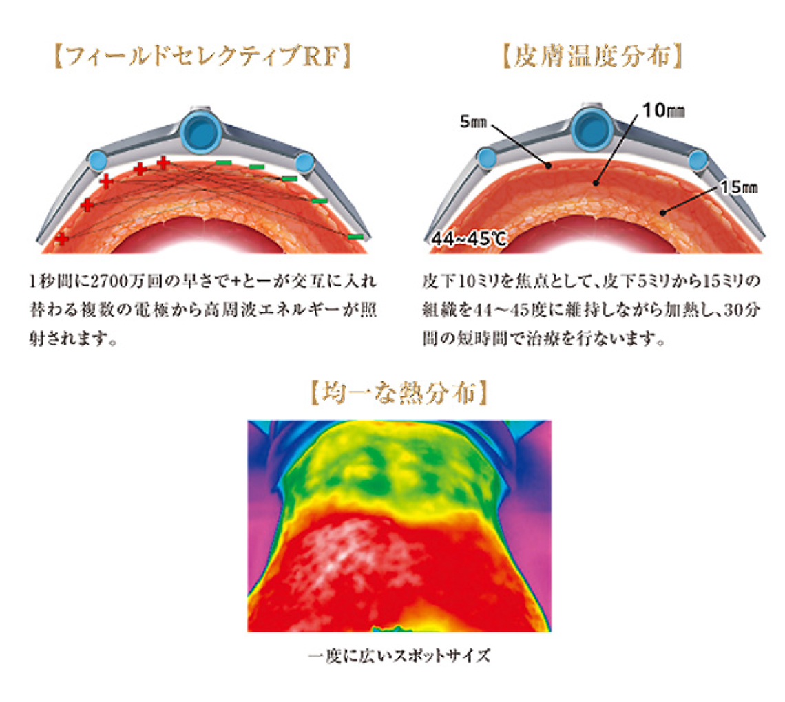 ヴァンキッシュの特徴