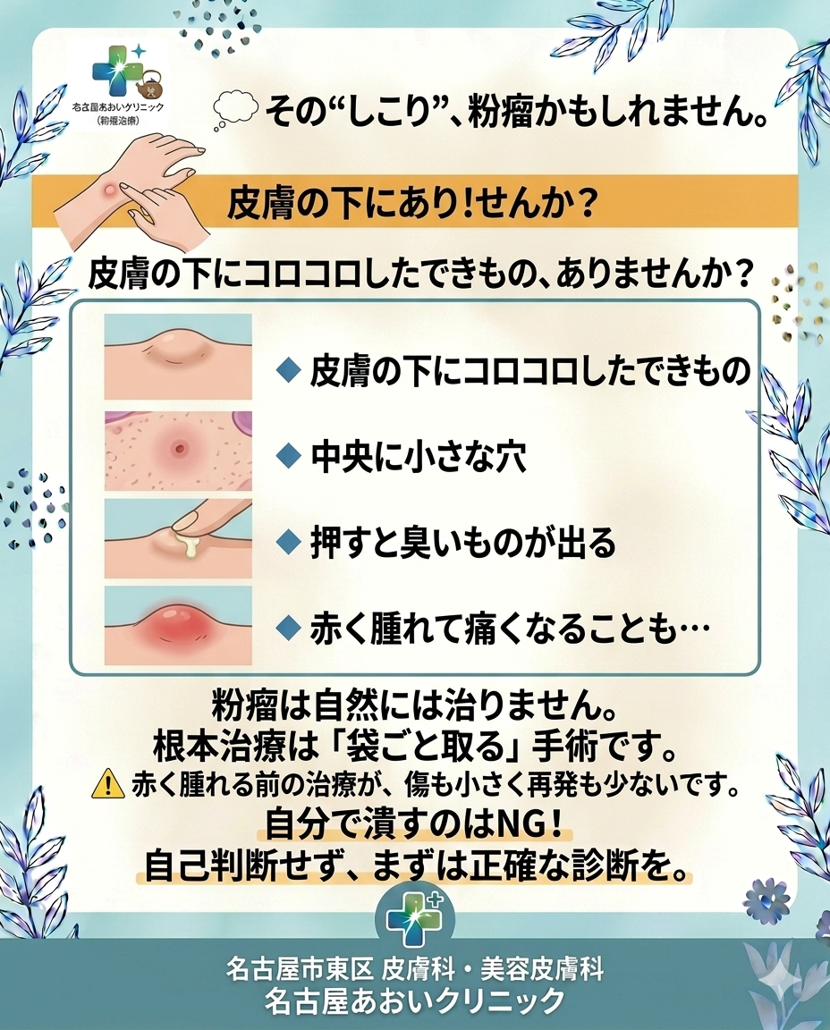粉瘤（ふんりゅう）の原因と治療について 　名古屋あおいクリニック