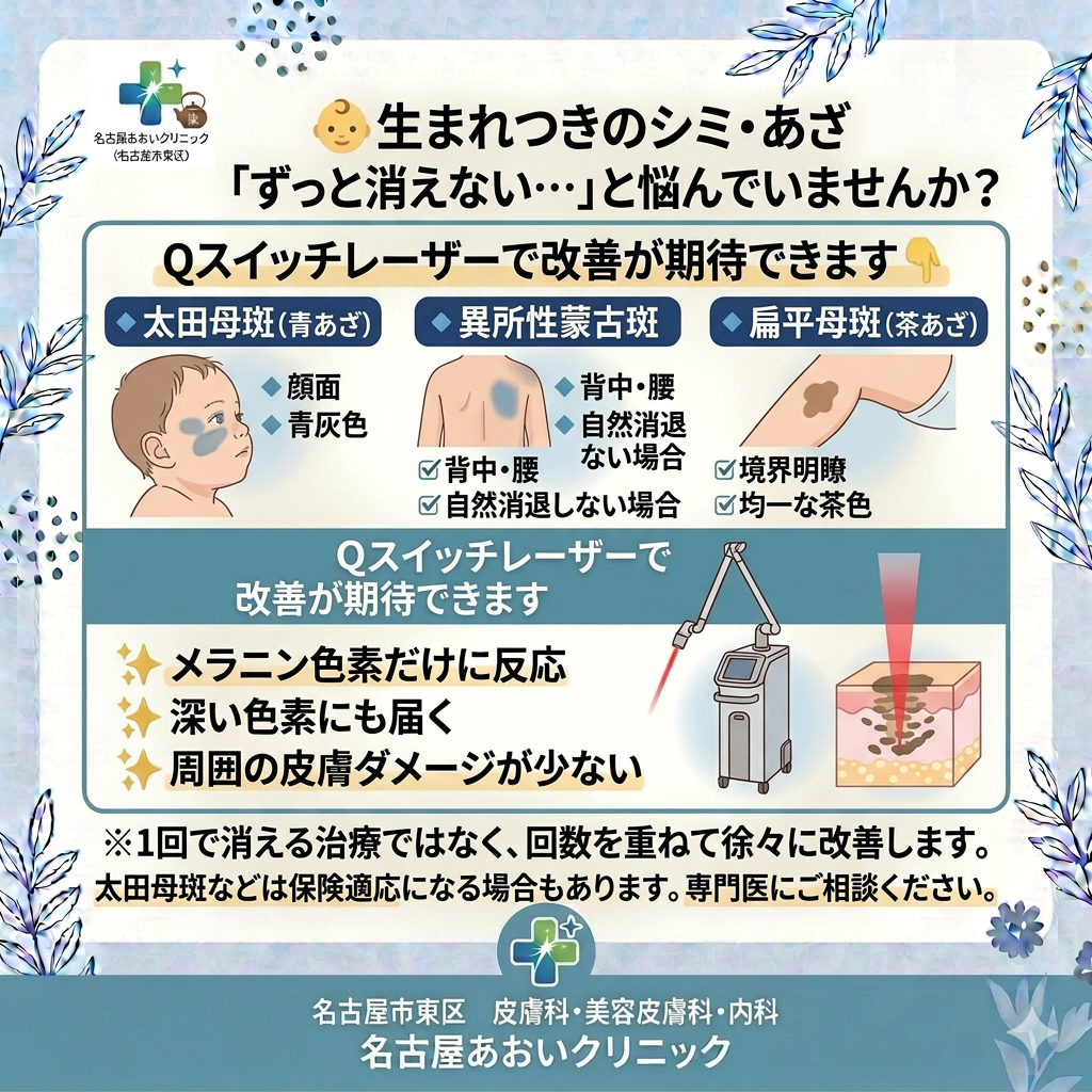 生まれつきのシミ・あざに対するQスイッチレーザーの有効性について　名古屋あおいクリニック