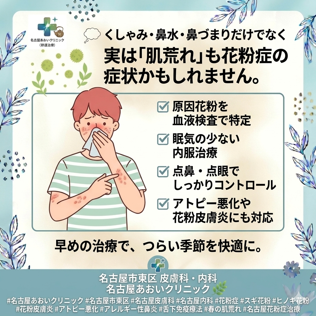 🌸 花粉症の診断と治療について　名古屋あおいクリニック