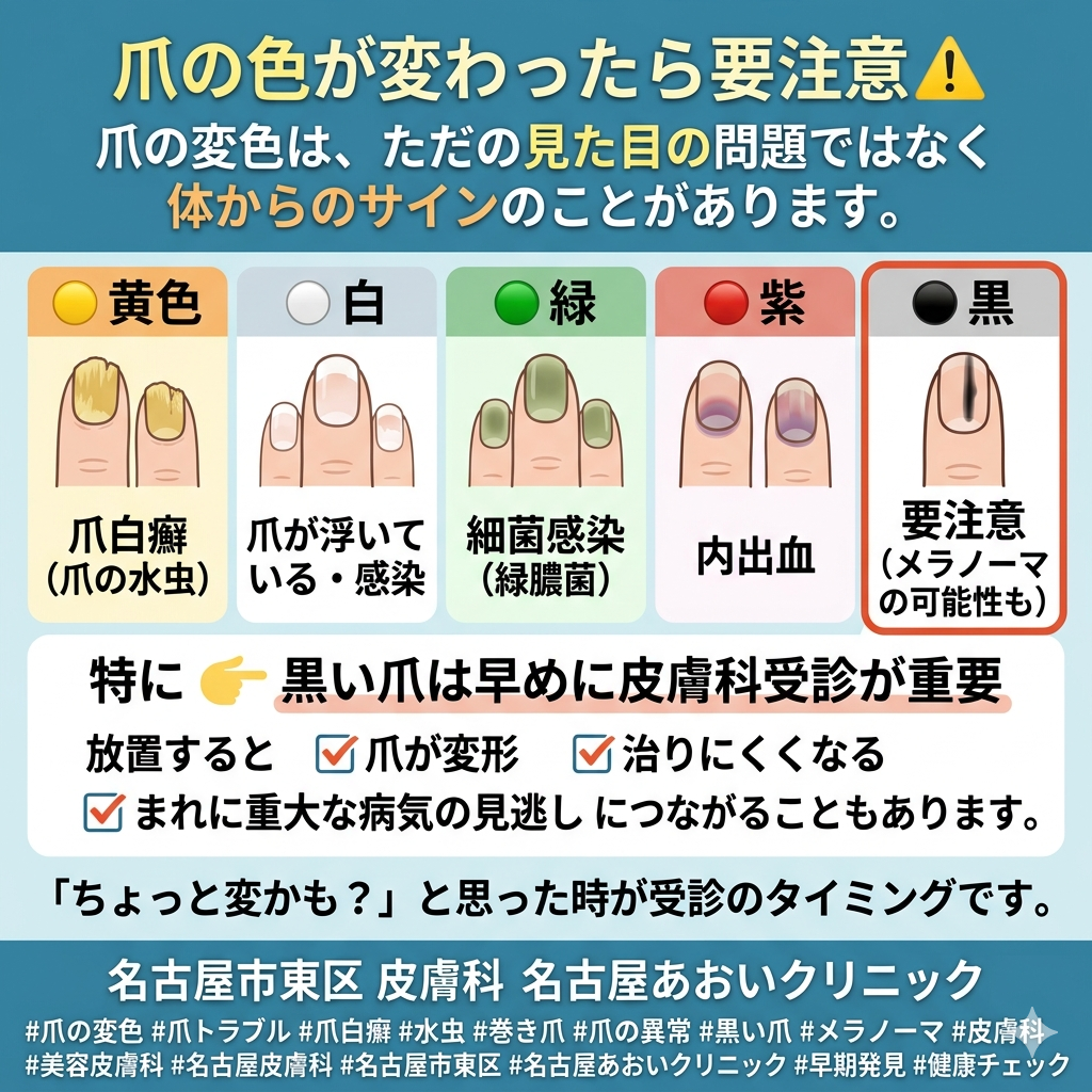爪の色が変色しているときに考えられる疾患と治療　名古屋あおいクリニック