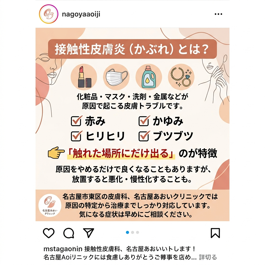 接触性皮膚炎とは？　名古屋あおいクリニック
