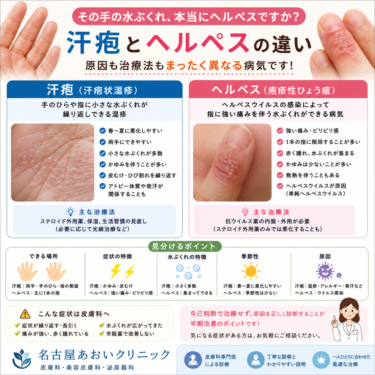 手にできる水ぶくれは汗疱？ヘルペス？見分け方と治療法を皮膚科医が詳しく解説