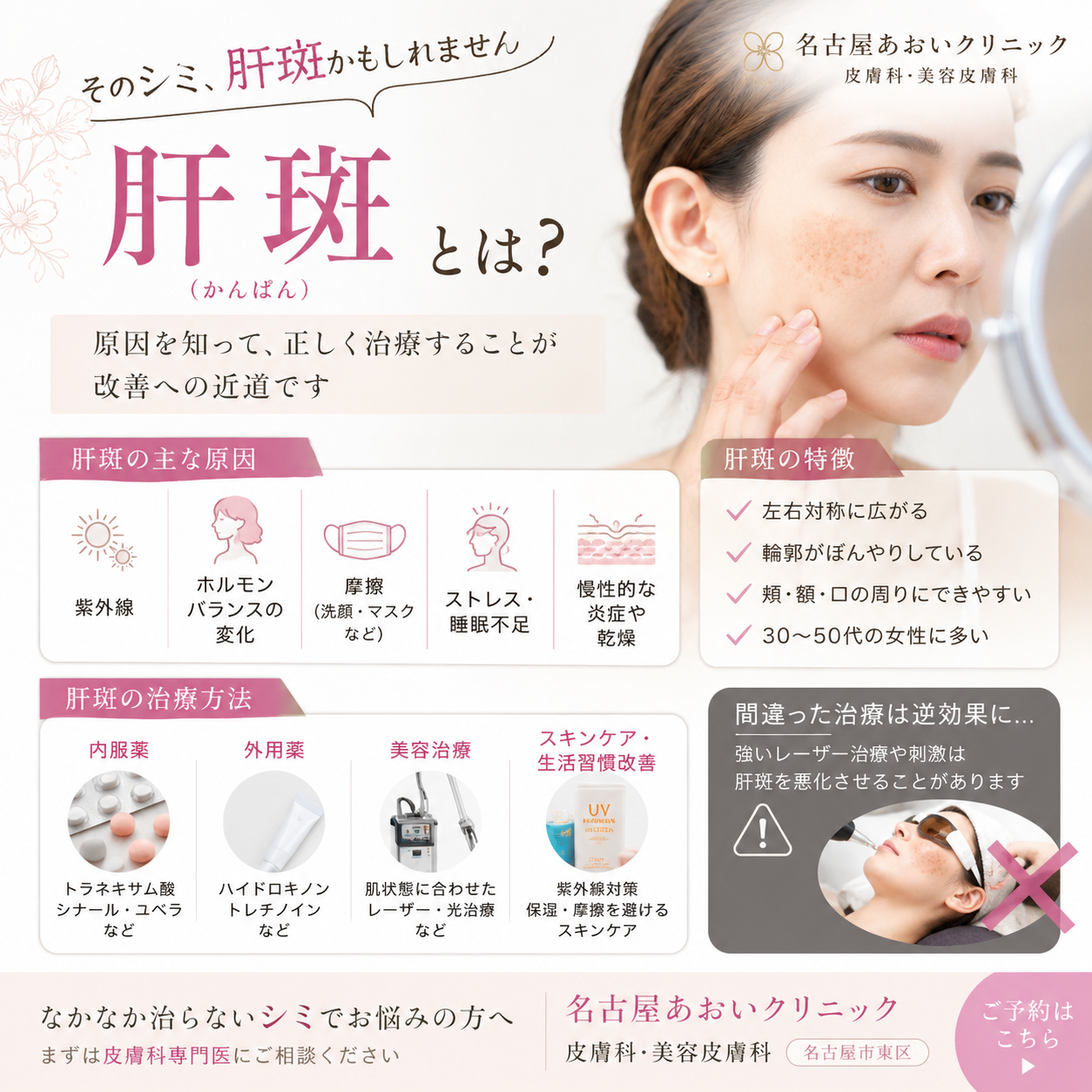 肝斑（かんぱん）とは？原因・治療法を皮膚科医が詳しく解説