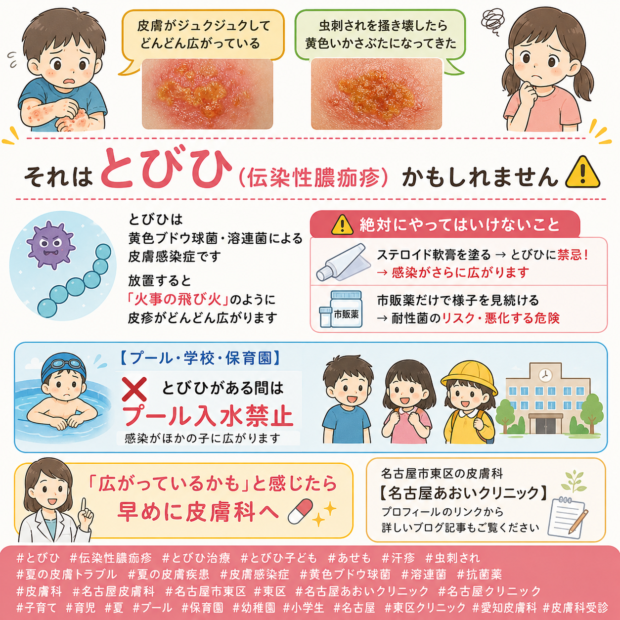 【夏の皮膚感染症】とびひ・あせも・虫刺されの悪化を防ぐ——正しいケアと受診のタイミングを名古屋あおいクリニック（名古屋市東区・皮膚科）が詳しく解説