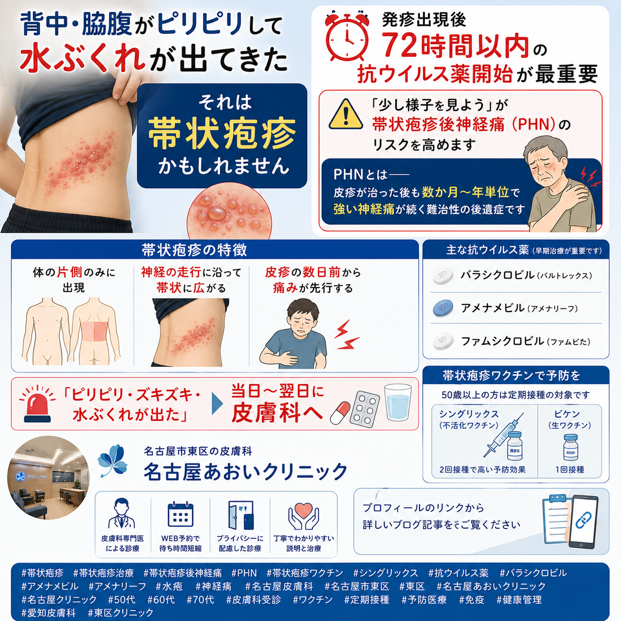 【2026年最新】帯状疱疹——症状・治療・ワクチン（シングリックス vs 生ワクチン）を名古屋あおいクリニック（名古屋市東区・皮膚科）が詳しく解説