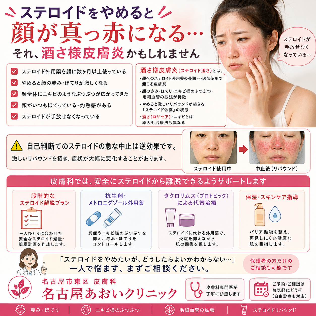 酒さ様皮膚炎（ステロイド酒さ）とは？原因・症状・治療法を皮膚科医が詳しく解説