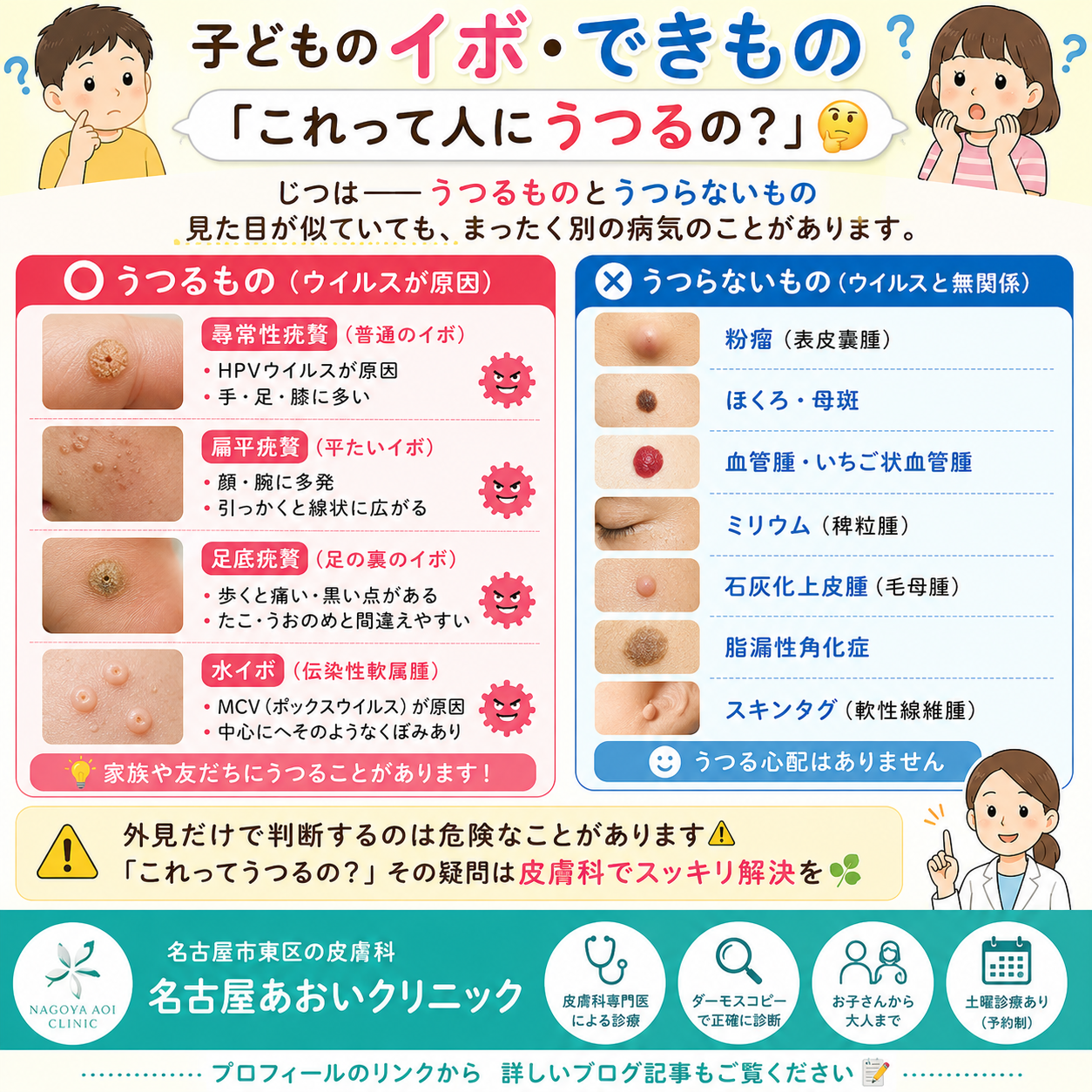 子どものイボ・できもの、うつるものとうつらないものの違いは？種類・見分け方・治療を名古屋あおいクリニック（名古屋市東区・皮膚科）が詳しく解説