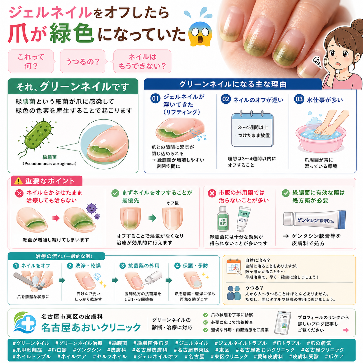 グリーンネイル（緑膿菌性爪炎）とは？予防と治療を名古屋あおいクリニック（名古屋市東区・皮膚科）が詳しく解説