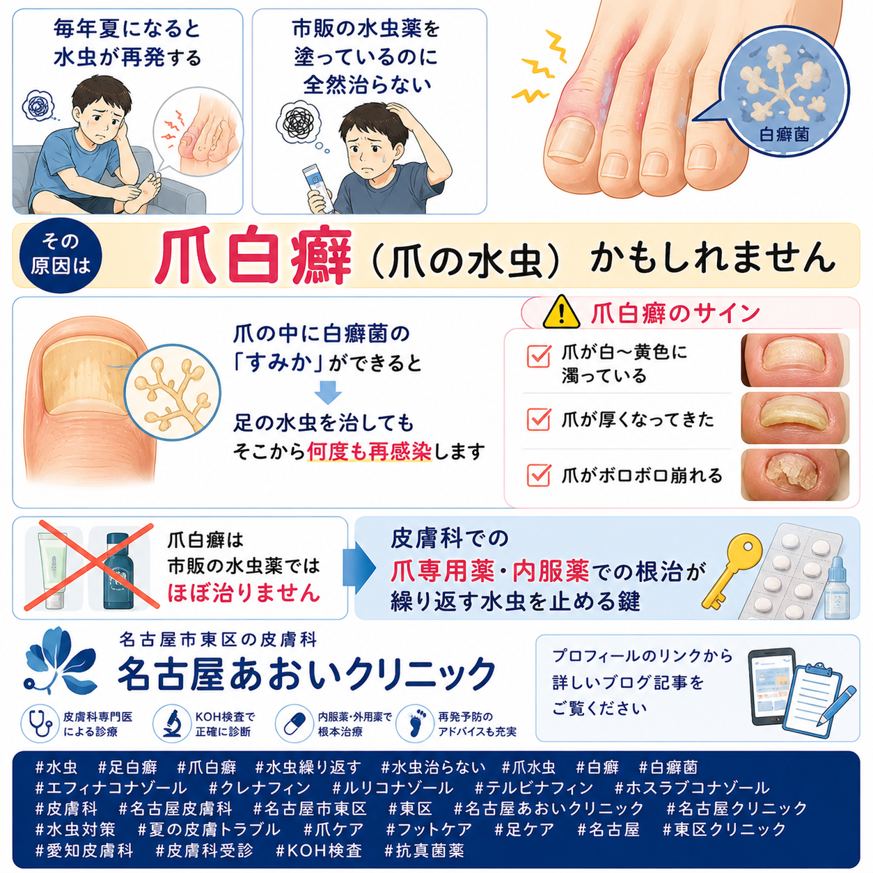 水虫（足白癬・爪白癬）——繰り返す・治らない原因と正しい治療を名古屋あおいクリニック（名古屋市東区・皮膚科）が詳しく解説